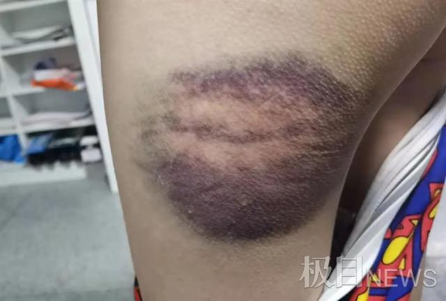 孩子离家出走家长毒打(当孩子离家出走,家长最需怎么做)(图3)