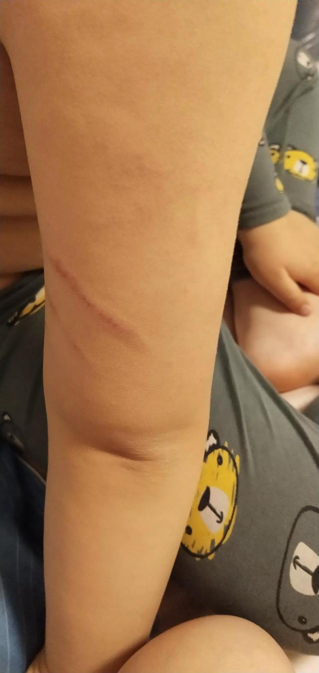 五岁孩子不听话该不该打(2岁多孩子不听话该不该打)(图1)