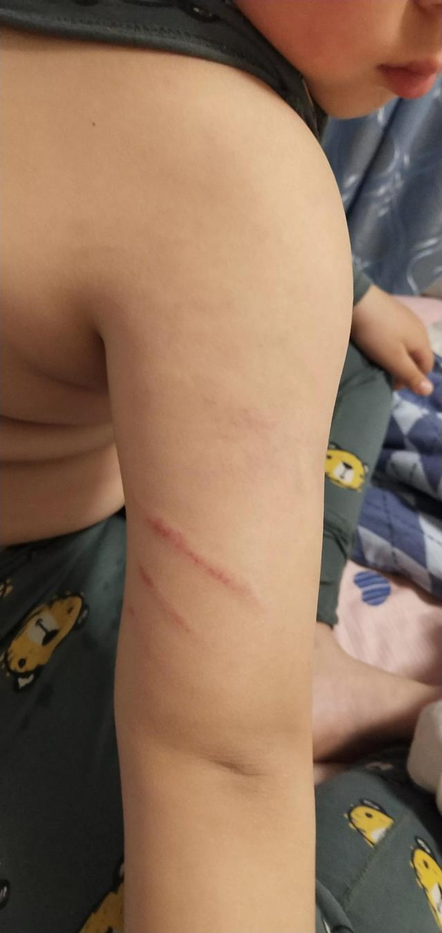 五岁孩子不听话该不该打(2岁多孩子不听话该不该打)(图2)